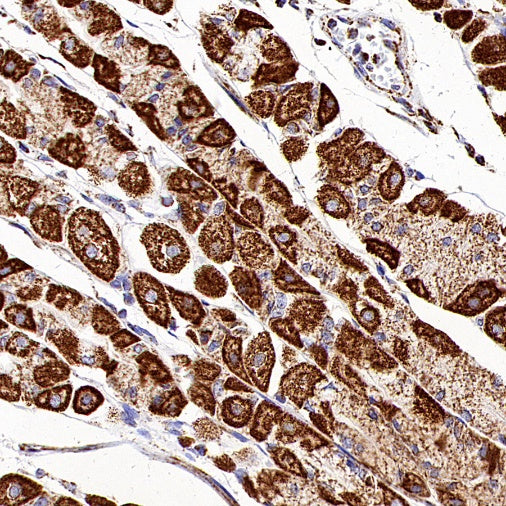 DLST Recombinant Rabbit mAb (S-2283-10)