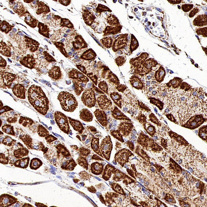 DLST Recombinant Rabbit mAb (S-2283-10)