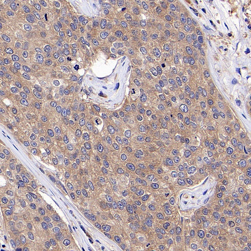 IKK gamma Recombinant Rabbit mAb (S-1359-118)