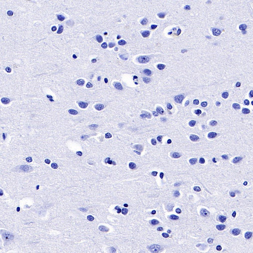 S-RMab® FSHB Recombinant Rabbit mAb (SDT-544-22)