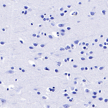 S-RMab® FSHB Recombinant Rabbit mAb (SDT-544-22)