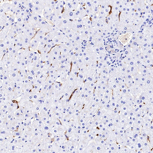 SLC40A1/Ferroportin Recombinant Rabbit mAb (S-2172-35)