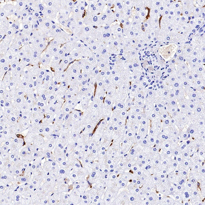 SLC40A1/Ferroportin Recombinant Rabbit mAb (S-2172-35)