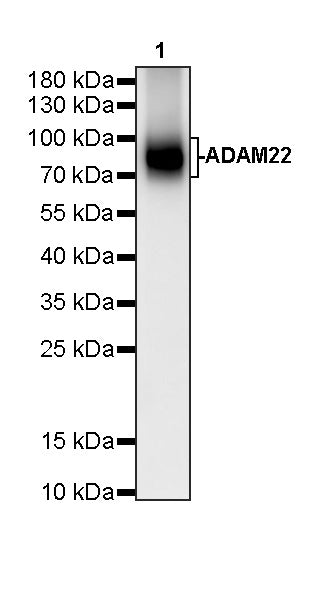 ADAM22 Recombinant Rabbit mAb (S-3201-8)