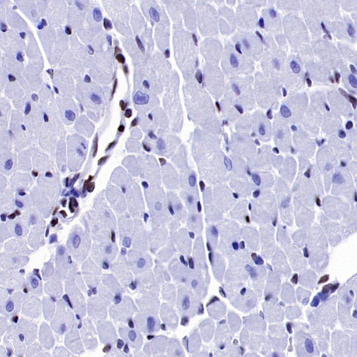 FOXC1 Recombinant Rabbit mAb (S-1607-142)