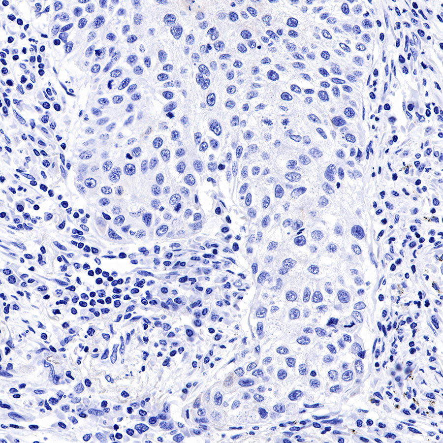 S-RMab® Keratin 18 Recombinant Rabbit mAb (SDT-012-7)