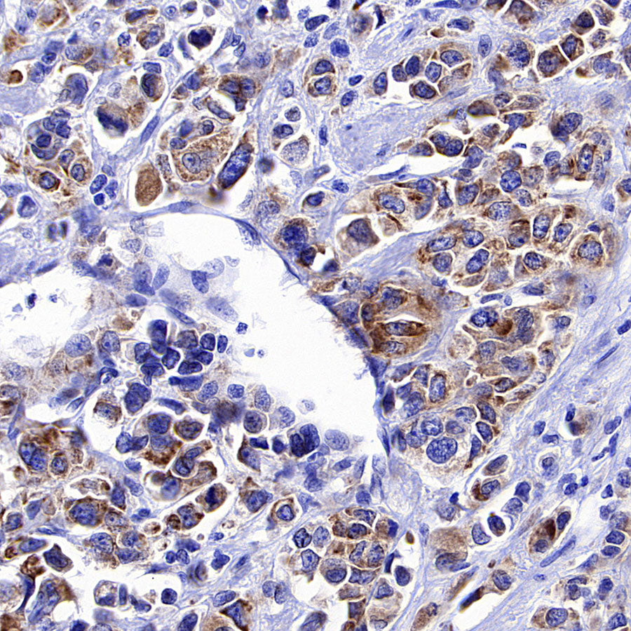 CCDC47 Recombinant Rabbit mAb (S-4158-17)