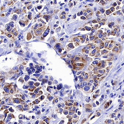 CCDC47 Recombinant Rabbit mAb (S-4158-17)