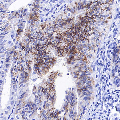 ALCAM Recombinant Rabbit mAb (S-4080-21)