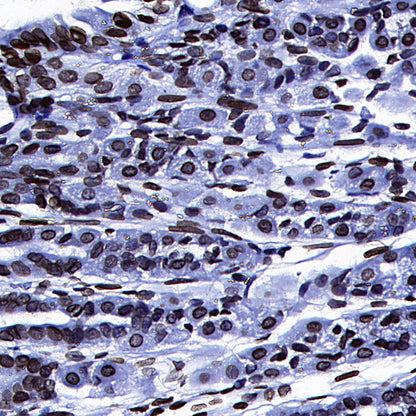 Lamin A/C Recombinant Rabbit mAb (S-5671)
