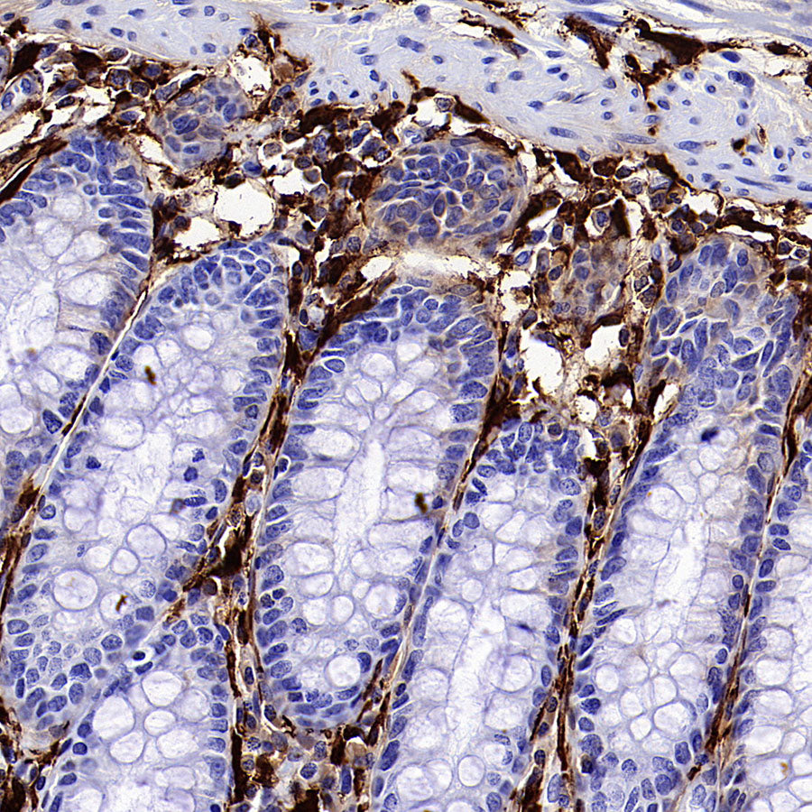 AOAH Recombinant Rabbit mAb (S-3713-10)
