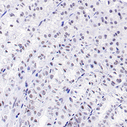 SMARCA3 Recombinant Rabbit mAb (S-3575-154)