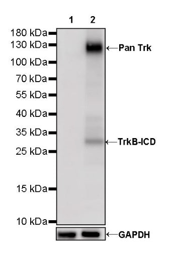 S-RMab® Pan Trk Recombinant Rabbit mAb (SDT-512-5)