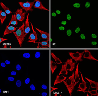 SP1 Recombinant Rabbit mAb (S-4102)