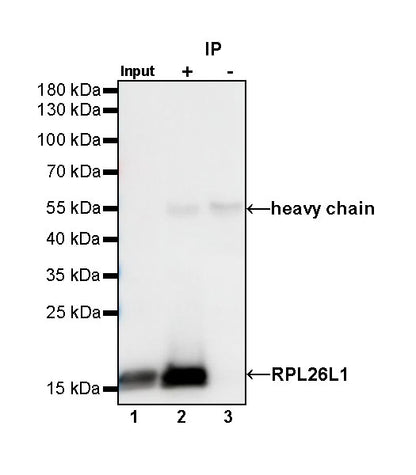 RPL26L1 Recombinant Rabbit mAb (S-R317)