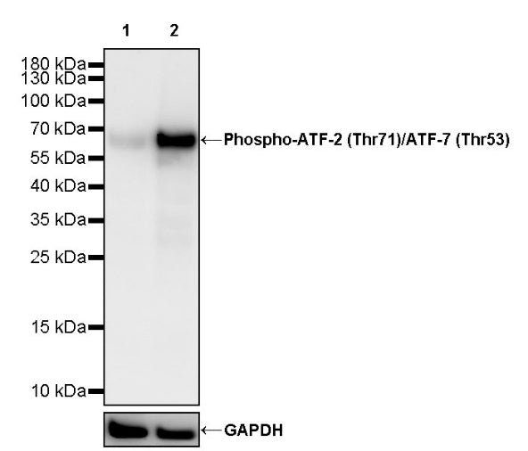 Phospho-ATF-2 (Thr71)/ATF-7 (Thr53) Recombinant Rabbit mAb (S-3535)