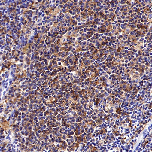 HLA-DRB1 Recombinant Rabbit mAb (SDT-R253)