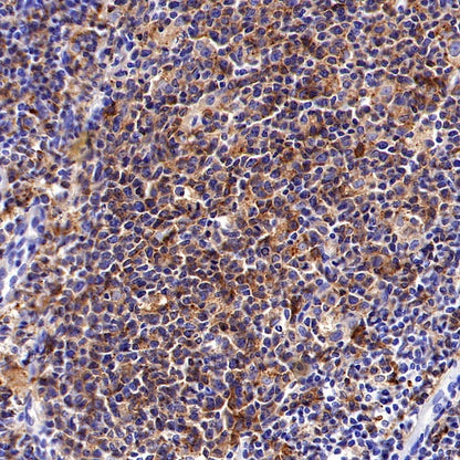 HLA-DRB1 Recombinant Rabbit mAb (SDT-R253)