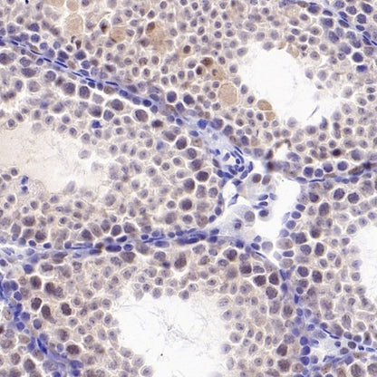 PSME4 Recombinant Rabbit mAb (S-3132-44)