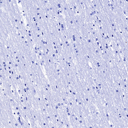 Cardiac Troponin I Recombinant Rabbit mAb (S-1352-15)