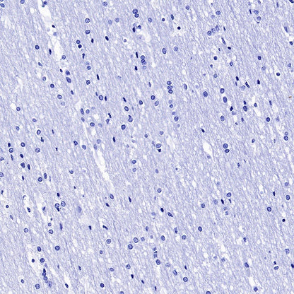 Cardiac Troponin I Recombinant Rabbit mAb (S-1352-15)