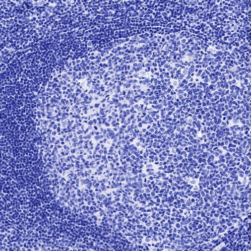 GLP-1 (active) Recombinant Rabbit mAb (S-R280)