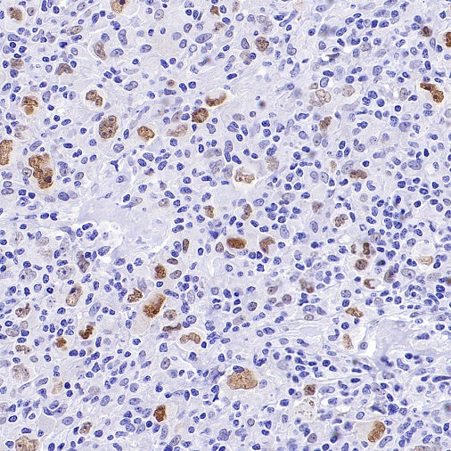 ATF3 Recombinant Rabbit mAb (SDT-4100)
