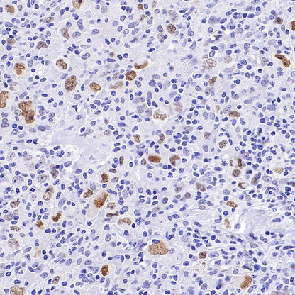 ATF3 Recombinant Rabbit mAb (SDT-4100)