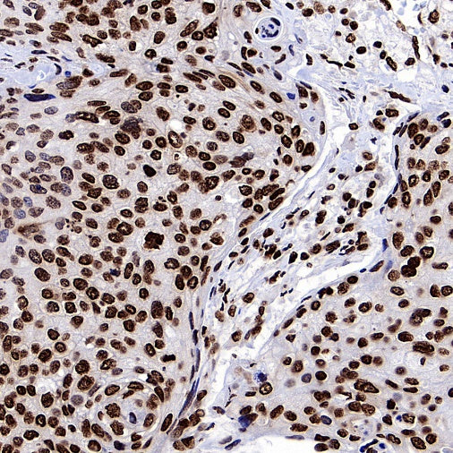 Histone H3 (di+tri methyl K79) Recombinant Rabbit mAb (S-854-48)