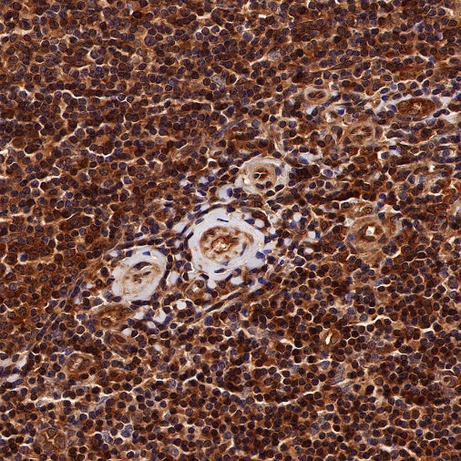 SBDS Recombinant Rabbit mAb (S-R344)