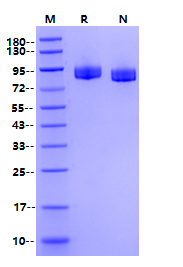 VCAM-1/CD106 His Tag Protein, Mouse