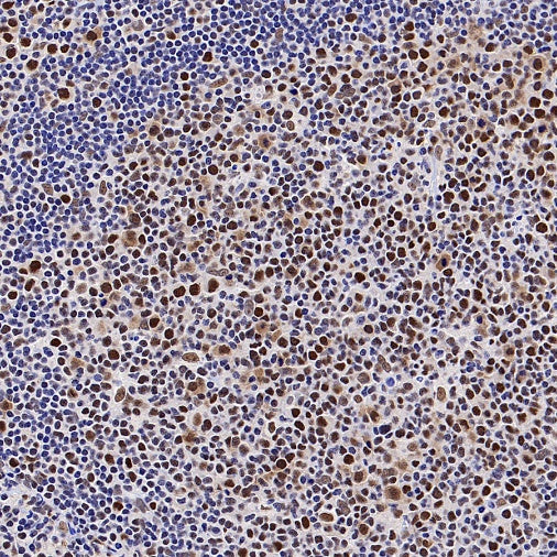 MLH1 Recombinant Mouse mAb (SDT-R702)