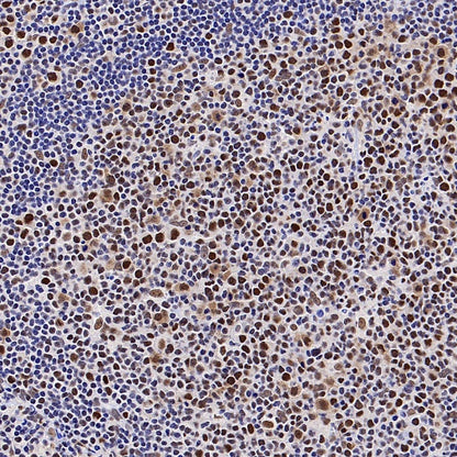 MLH1 Recombinant Mouse mAb (SDT-R702)