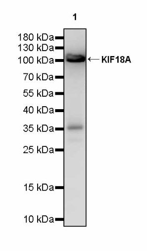KIF18A Recombinant Rabbit mAb (S-3310-11)
