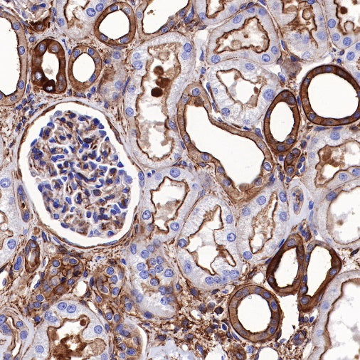 Non-muscle Myosin IIB/MYH10 Recombinant Rabbit mAb (S-299-3)