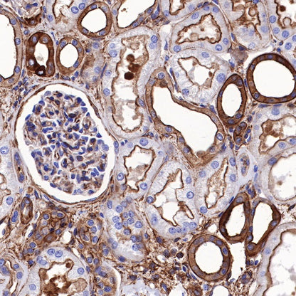 Non-muscle Myosin IIB/MYH10 Recombinant Rabbit mAb (S-299-3)
