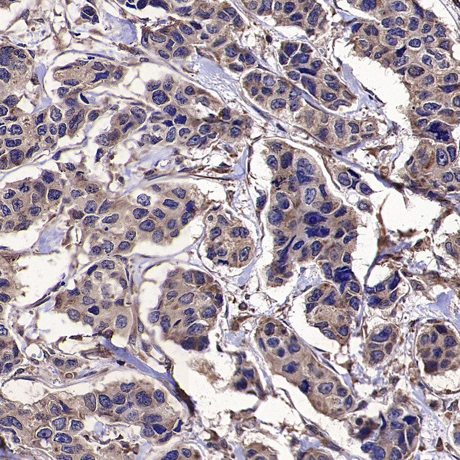 DOCK11 Recombinant Rabbit mAb (S-4420-57)