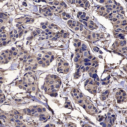 DOCK11 Recombinant Rabbit mAb (S-4420-57)