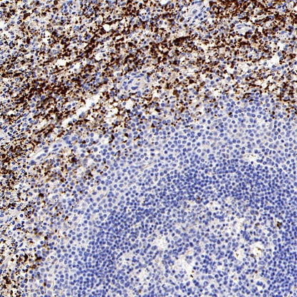 S-RMab® Factor XIIIa Recombinant Rabbit mAb (SDT-R278)