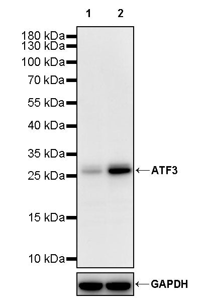 ATF3 Recombinant Rabbit mAb (S-3904)