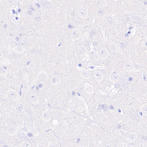 Prolactin/PRL Recombinant Rabbit mAb (S-235-215)