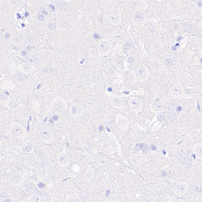 Prolactin/PRL Recombinant Rabbit mAb (S-235-215)