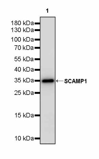 SCAMP1 Rabbit Polyclonal Antibody