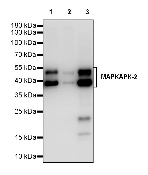 MAPKAPK-2 Recombinant Rabbit mAb (S-2641-58)