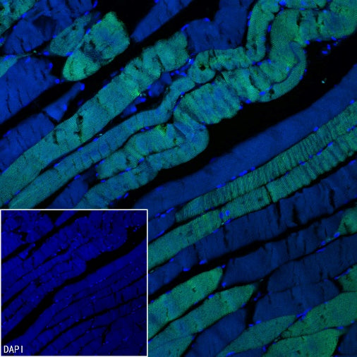 MYH7 Recombinant Rabbit mAb ,PBS Only (SDT-2936-44)