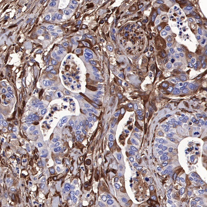 Lumican Recombinant Rabbit mAb (S-247-47)