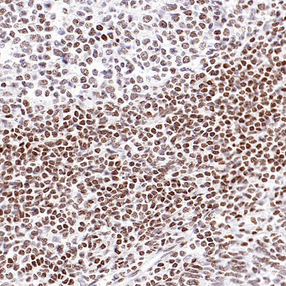KDM5D Recombinant Rabbit mAb (S-1577-128)