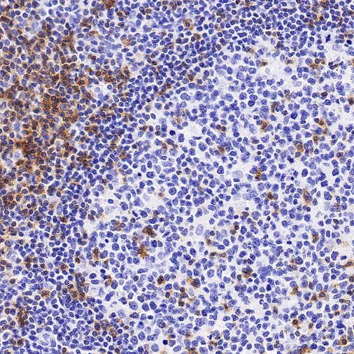 CD6 Recombinant Rabbit mAb (S-1512-39)