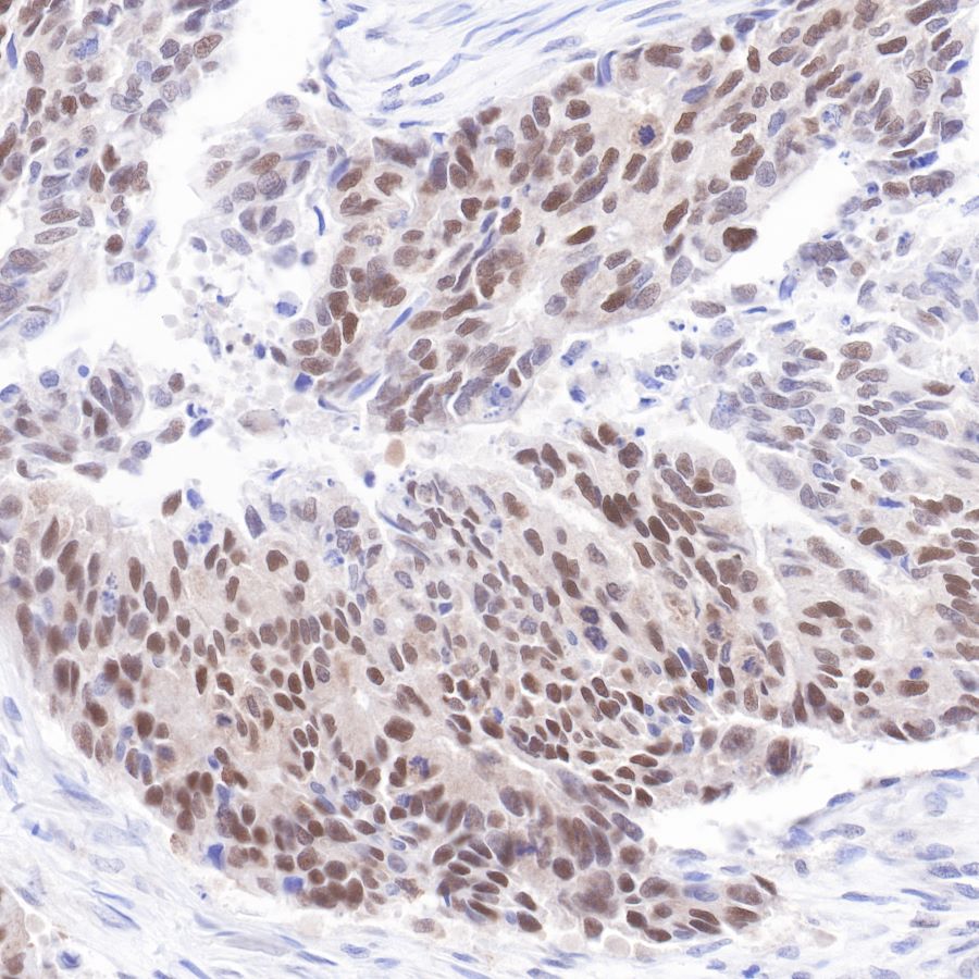 p53 Recombinant Rabbit mAb (SDT-100-72)