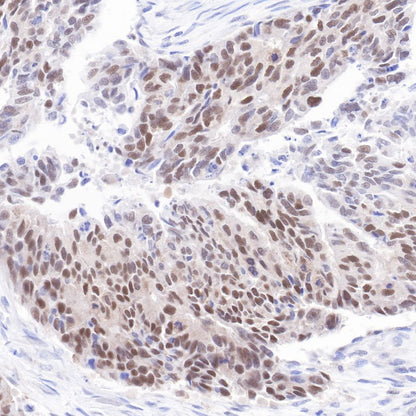 p53 Recombinant Rabbit mAb (SDT-100-72)